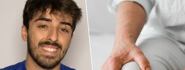 Pedro Azañón, fisioterapeuta: "La artrosis de rodilla es un proceso degenerativo natural y el dolor se puede deber a la inflamación, la inactividad u otros factores relacionados con el estilo de vida"