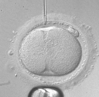 Trasplante de óvulos, una demanda creciente