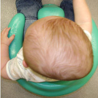 Plagiocefalia: ¿Cómo prevenir y tratar la cada vez más frecuente deformidad de cabeza de los bebés?