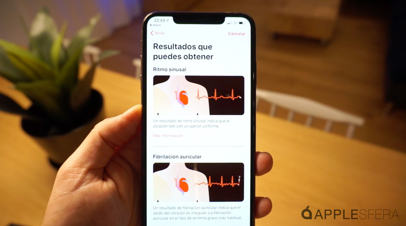 Apple activa el electrocardiograma en el Apple Watch Series 4 y ya lo ...