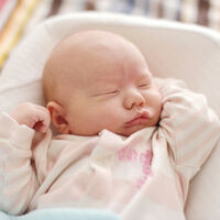 ¿Qué son las manchas tipo "vino de Oporto" en los bebés?