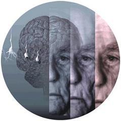 Prevenir el Alzheimer con la alimentación