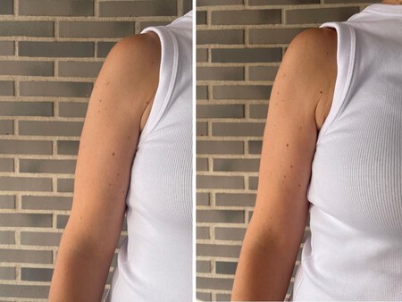 Bronceado Brazo