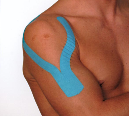 kinesiotape.png