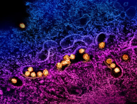 Virus del Nilo Occidental