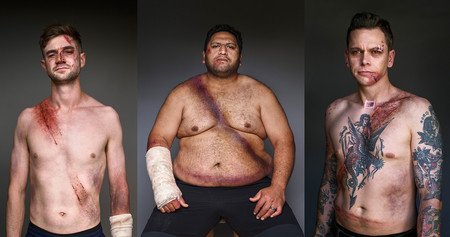 ‘Belted Survivors’, mostrando las huellas que deja el cinturón de seguridad en caso de accidente para concienciar de su uso