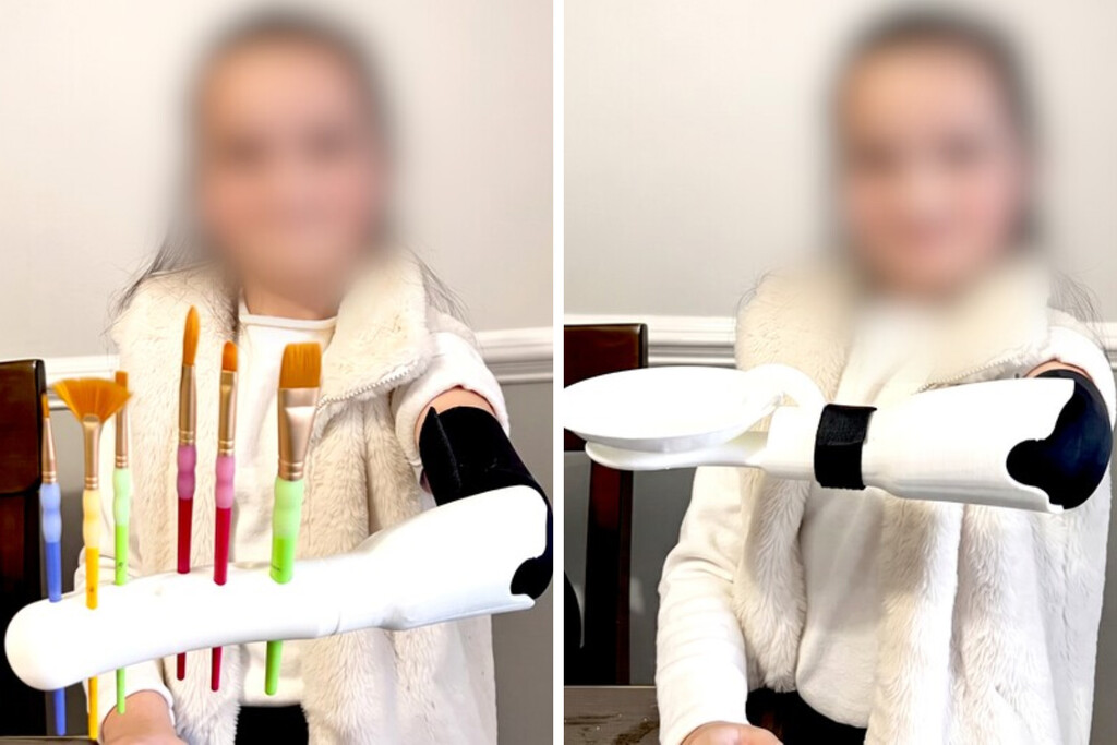 Un estudiante pasó más de 100 horas frente a una impresora 3D para desarrollar una prótesis multifuncional para su hermana de 7 años
