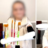 Un estudiante pasó más de 100 horas frente a una impresora 3D para desarrollar una prótesis multifuncional para su hermana de 7 años 