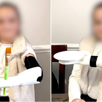 Estudante passou mais de 100 horas com impressora 3D para desenvolver prótese de braço multifuncional para irmã de 7 anos 