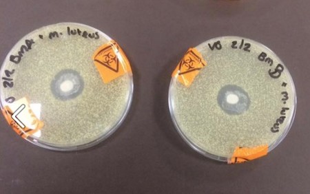 ¿Por qué estas placas de laboratorio con leche materna dejan a todo el mundo alucinado?