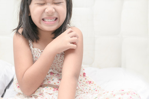Herpes zóster en niños: por qué aparece y cómo se trata