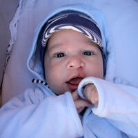 Fisura labiopalatina en bebés y niños: qué consecuencias tiene esta malformación congénita y cuál es su tratamiento 