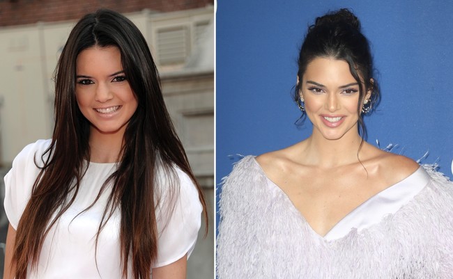 Kardashian Cirugia 03