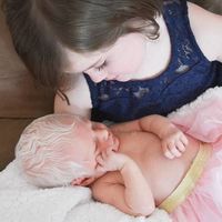 "Es un hada de las nieves. Se parece a Elsa de Frozen": la tierna reacción de una niña de cinco años al conocer a su hermana con albinisimo