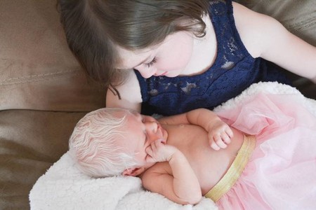 "Es un hada de las nieves. Se parece a Elsa de Frozen": la tierna reacción de una niña de cinco años al conocer a su hermana con albinisimo