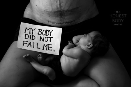 "Mi cuerpo no me falló", las impresionantes fotos de una madre después de tres cesáreas