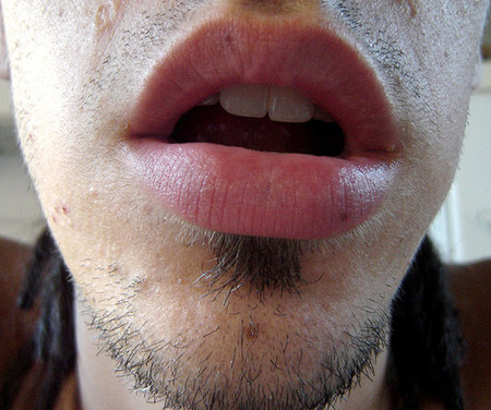 El origen de la halitosis cuando la alimentación no causa el mal aliento
