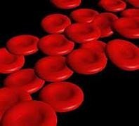 Anemia sideropénica