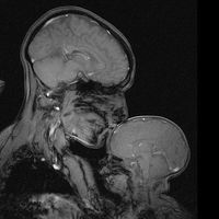 La historia tras la resonancia magnética que mostró a una madre durmiendo a su bebé