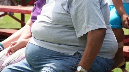 Una persona obesa no es una persona bien nutrida
