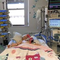 Una niña de cinco años que había superado el coronavirus, lucha por su vida tras contraer la enfermedad de Kawasaki 