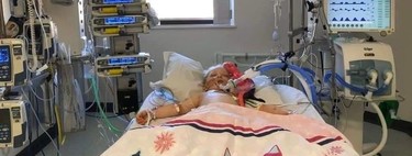 Una niña de cinco años que había superado el coronavirus, lucha por su vida tras contraer la enfermedad de Kawasaki 