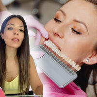 Carolina Olivares, dentista: "Cuando tú blanqueas tus dientes, los tendrás que blanquear toda tu vida" 