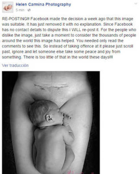 Helen-Allen-foto-Cicatriz