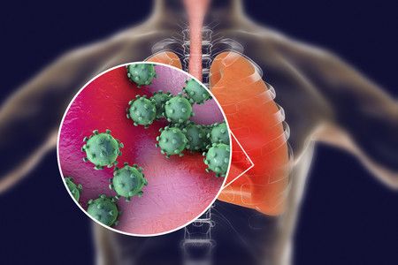 virus respiratorio