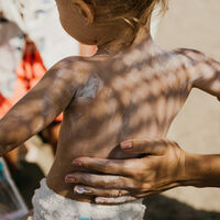Así deben ser los protectores solares infantiles para prevenir el cáncer de piel a futuro  
