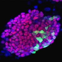 Células madre andaluzas