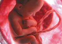 Placenta previa, ¿qué es?