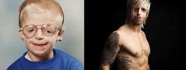 Sus padres le abandonaron al nacer por su "cara fea": hoy es un ejemplo para los niños que sufren su rara enfermedad