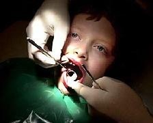 La infancia valenciana goza de una estupenda salud bucodental