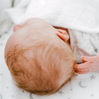 ¿Por qué a mi bebé se le cae el pelo y tiene calvas en la cabeza?  