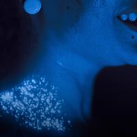 O detalhe que a série da Netflix não conta: por que um aparelho comum escondia pó de Césio 