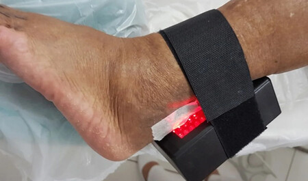 Curativo no tornozelo.