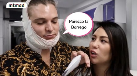El novio de Steisy entra en quirófano para acabar con su papada y flipan con el resultado: "Pareces una tortuga ninja"
