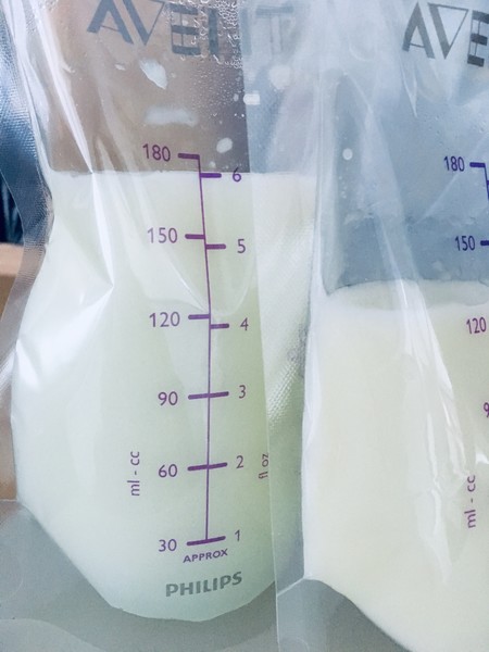 Leche materna aguada