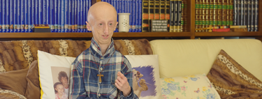 Sammy Basso, el científico que dedicó su vida a investigar la enfermedad que él mismo padecía y aceleraba su envejecimiento 