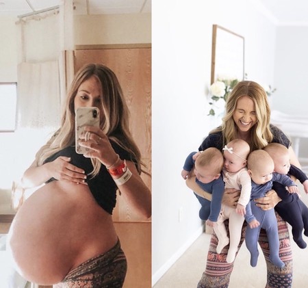 La foto del antes y el después de una madre de cuatrillizos