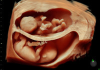 Increíbles imágenes que muestran cómo serán las nuevas ecografías en 3D