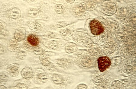 clamidia-bacteria-cultivo