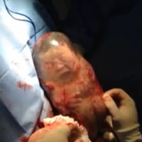 El increíble vídeo de un bebé que nace dentro de la bolsa y se mueve sin saber que ha nacido