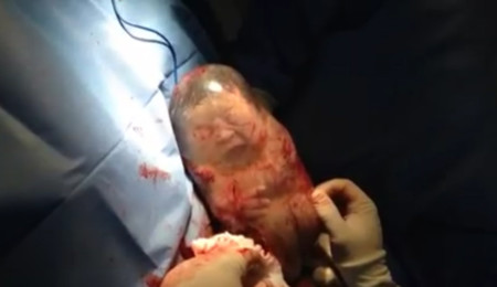 El increíble vídeo de un bebé que nace dentro de la bolsa y se mueve sin saber que ha nacido