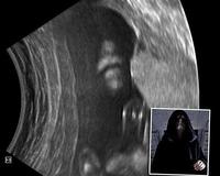 Ecografías curiosas: el emperador de la Guerra de las Galaxias 