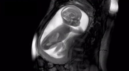 Un vídeo muestra cómo serán las 'ecografías' en el futuro