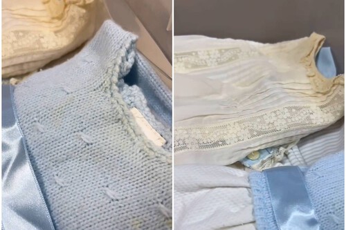 Quitar manchas amarillas de la ropa guardada