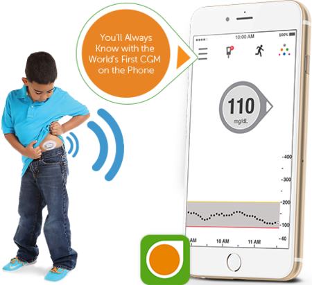 Dexcom G5 monitoriza tus niveles de glucosa constantemente en el móvil