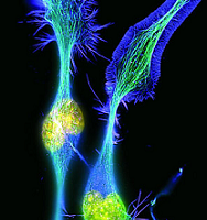 Menos posibilidades de sufrir esclerosis múltiple con la exposición solar durante la infancia